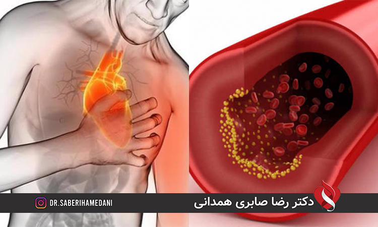 خطرات آنژین پکتوریس قلبی